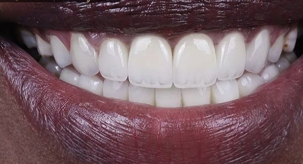 DEL Dental & Implant Clinic | Ghana 🇬🇭 — Accra