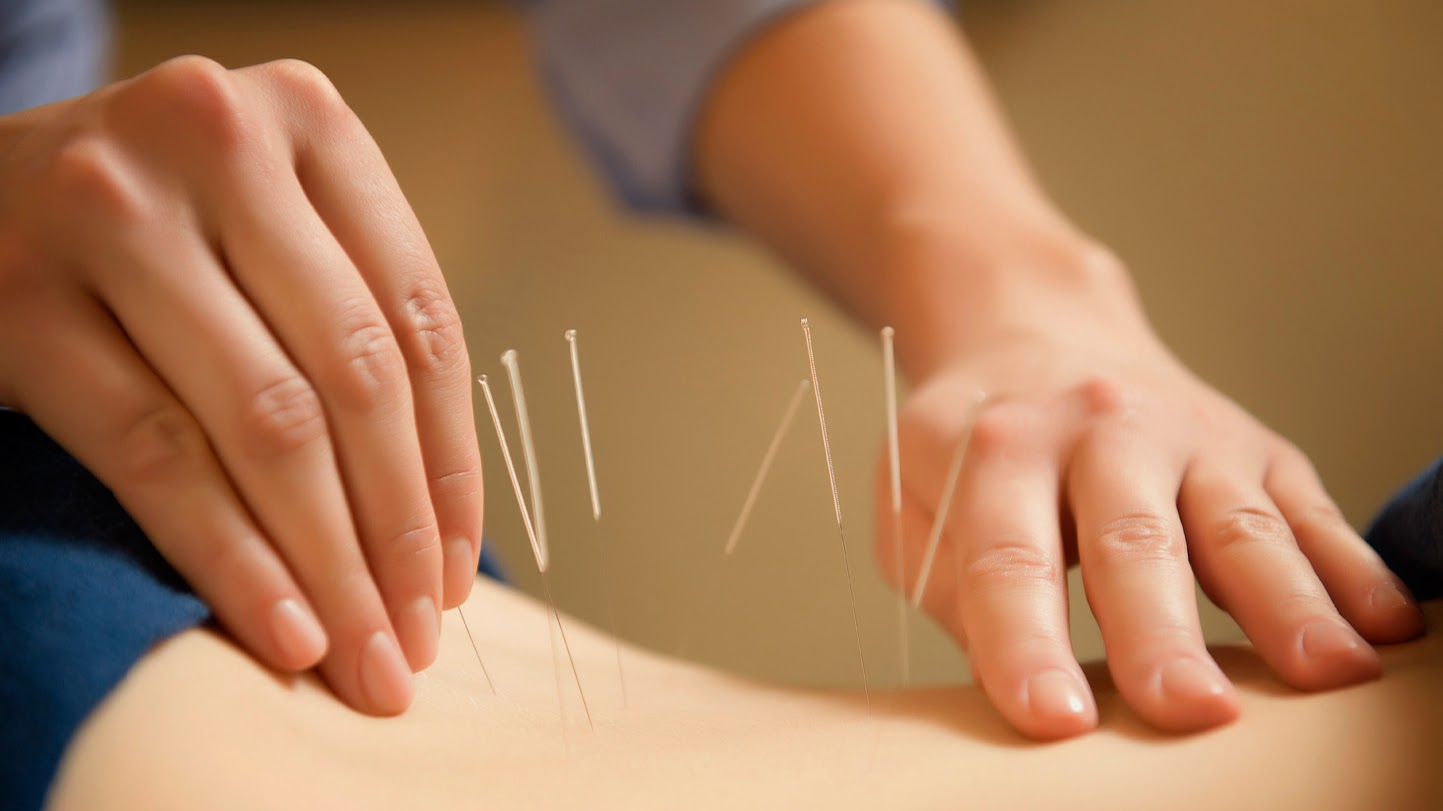 Naturopathy Yoga & Acupuncture Centre | Kenya 🇰🇪 — Nairobi
