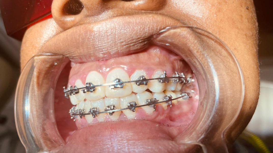 Royal Smile Dental Clinic | New GRA | Port Harcourt | Nigeria 🇳🇬 — Port Harcourt