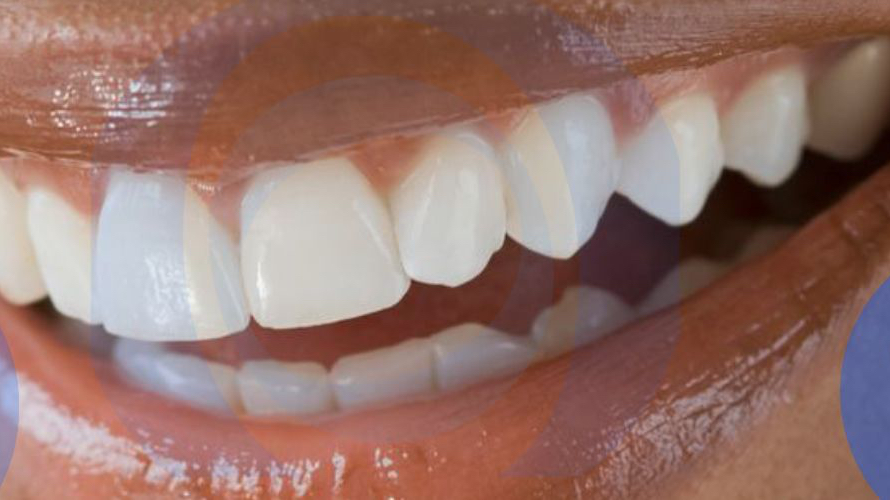 Oga Dentist Yaba | Dental Clinic in Lagos | Nigeria 🇳🇬 — Lagos