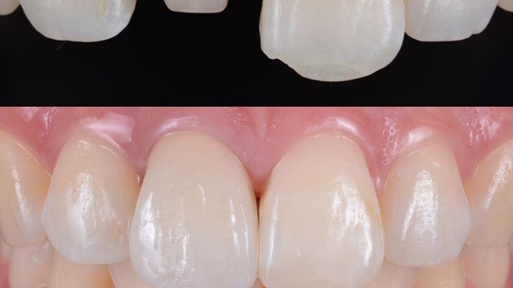 Coldent Dental Clinic | Nigeria 🇳🇬 — Ikeja