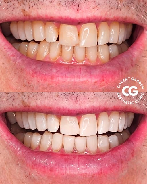Covent Garden Aesthetic Clinic | UK 🇬🇧