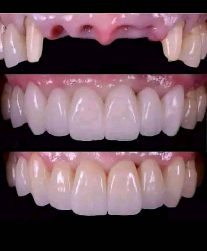 Jil Dental Clinic | Uganda 🇺🇬